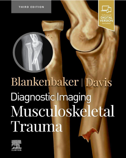 Diagnostic Imaging: Musculoskeletal Trauma